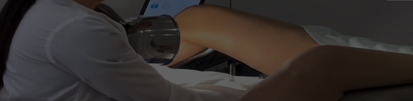 Tratamiento láser ginecológico